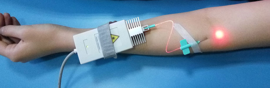 ВЛОК - Внутривенное лазерное облучение крови  в Одинцово